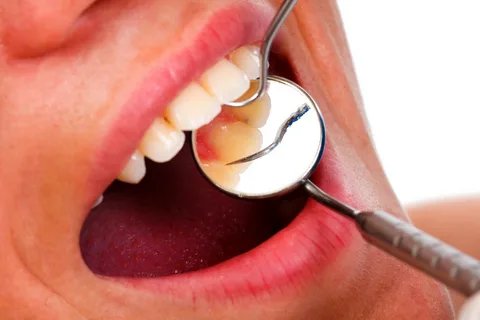 Dental Services- Gum Treatment