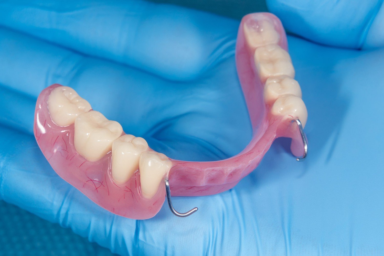 zDental Services- Partial & Complete Dentures